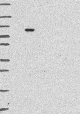 Western Blot LZTR1 Antibody - BSA Free