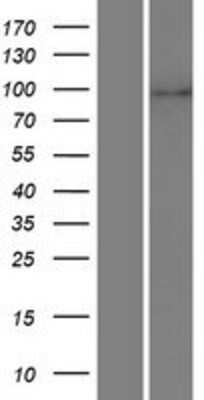 Western Blot: LZTR1 Overexpression Lysate (Adult Normal) [NBP2-07586] Left-Empty vector transfected control cell lysate (HEK293 cell lysate); Right -Over-expression Lysate for LZTR1.