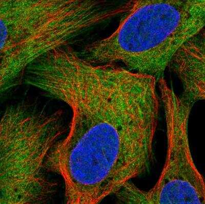 Immunocytochemistry/Immunofluorescence: LZTR2 Antibody [NBP2-55068] - Staining of human cell line U-2 OS shows localization to plasma membrane, endoplasmic reticulum & actin filaments. Antibody staining is shown in green.