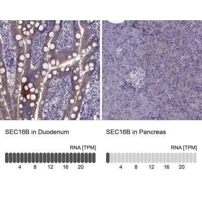 <b>Orthogonal Strategies Validation. </b>Immunohistochemistry-Paraffin: LZTR2 Antibody [NBP2-62678] - Analysis in human duodenum and pancreas tissues using Anti-SEC16B antibody. Corresponding SEC16B RNA-seq data are presented for the same tissues.