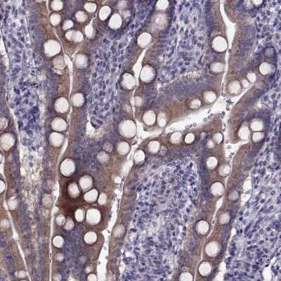 Immunohistochemistry-Paraffin LZTR2 Antibody