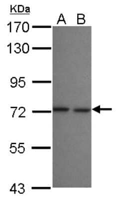 Western Blot: LZTR2 Antibody [NBP2-17194] - Sample (30 ug of whole cell lysate) A: A549 B: HeLa 7. 5% SDS PAGE gel, diluted at 1:1000.