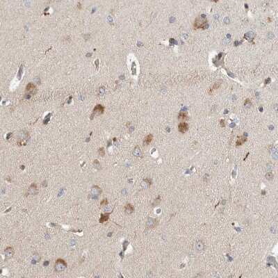 Immunohistochemistry-Paraffin: LZTS1 Antibody [NBP1-83907] - Staining of human cerebral cortex shows moderate cytoplasmic positivity in neurons.