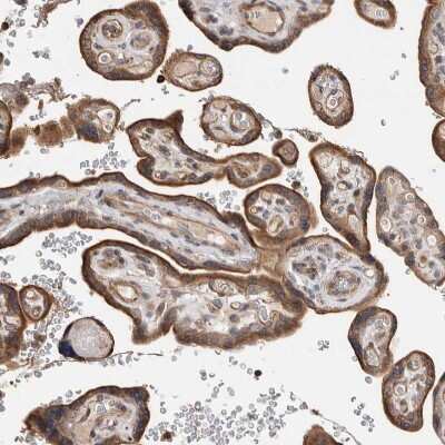 Immunohistochemistry-Paraffin: LZTS1 Antibody [NBP1-83907] - Staining of human placenta shows strong cytoplasmic positivity in trophoblastic cells.