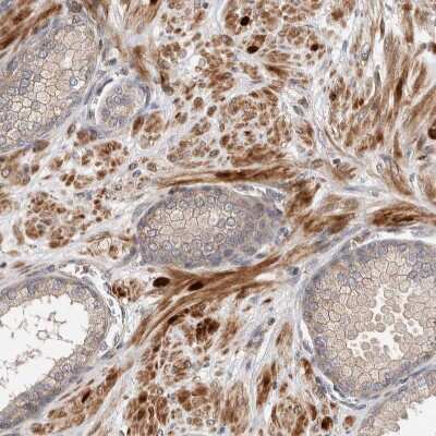 Immunohistochemistry-Paraffin: LZTS1 Antibody [NBP1-83907] - Staining of human prostate shows moderate cytoplasmic positivity in smooth muscle cells.
