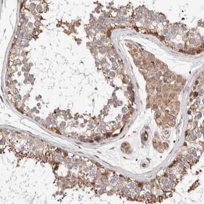 Immunohistochemistry-Paraffin: LZTS1 Antibody [NBP1-83907] - Staining of human testis shows moderate cytoplasmic positivity in Leydig cells.