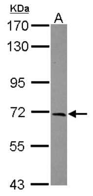 Western Blot: LZTS1 Antibody [NBP2-17195] - Sample (30 ug of whole cell lysate) A: U87-MG 7. 5% SDS PAGE gel, diluted at 1:1000.