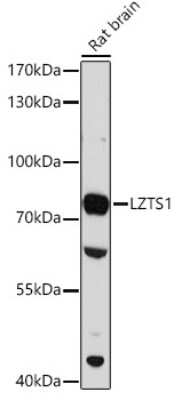 Western Blot: LZTS1 Antibody [NBP3-04969] - Western blot analysis of extracts of Rat brain, using LZTS1 antibody (NBP3-04969) at 1:3000 dilution. Secondary antibody: HRP Goat Anti-Rabbit IgG (H+L) at 1:10000 dilution. Lysates/proteins: 25ug per lane. Blocking buffer: 3% nonfat dry milk in TBST. Detection: ECL Enhanced Kit. Exposure time: 90s.