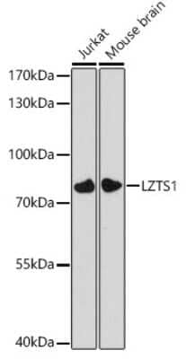 Western Blot: LZTS1 Antibody [NBP3-04969] - Western blot analysis of extracts of various cell lines, using LZTS1 antibody (NBP3-04969) at 1:3000 dilution. Secondary antibody: HRP Goat Anti-Rabbit IgG (H+L) at 1:10000 dilution. Lysates/proteins: 25ug per lane. Blocking buffer: 3% nonfat dry milk in TBST. Detection: ECL Basic Kit. Exposure time: 90s.