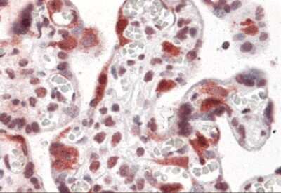 Immunohistochemistry: LZTS2 Antibody [NBP2-41099] - Immunohistochemistry of LZTS2 in human placenta tissue with LZTS2 antibody at 5 ug/mL.