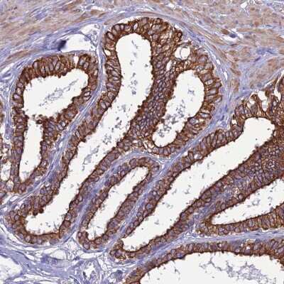 Immunohistochemistry-Paraffin: LZTS2 Antibody [NBP1-82892] - Staining of human prostate shows strong membranous and cytoplasmic positivity in glandular cells.