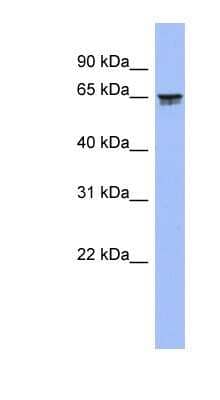 Western Blot: LZTS2 Antibody [NBP1-58275] - Human Spleen lysate, concentration 0.2-1 ug/ml.