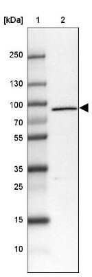 Western Blot: LZTS2 Antibody [NBP1-82892] - Lane 1: Marker [kDa] 250, 130, 100, 70, 55, 35, 25, 15, 10Lane 2: Human Tonsil tissue