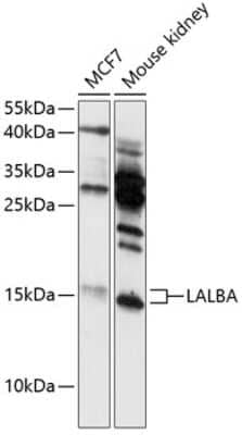 Western Blot: Lactalbumin Alpha Antibody [NBP3-03561] - Analysis of extracts of various cell lines, using Lactalbumin Alpha antibody at 1:3000 dilution. Secondary antibody: HRP Goat Anti-Rabbit IgG (H+L) at 1:10000 dilution. Lysates/proteins: 25ug per lane. Blocking buffer: 3% nonfat dry milk in TBST.