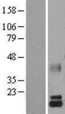 Western Blot Lactalbumin Alpha Overexpression Lysate