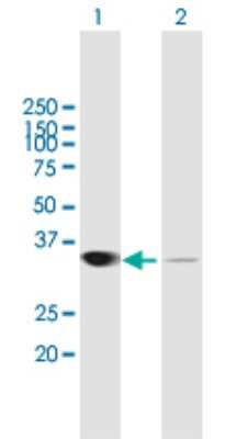 Western Blot: Lactate Dehydrogenase A/LDHA Antibody [H00003939-B01P] - Analysis of LDHA expression in transfected 293T cell line by LDHA polyclonal antibody.  Lane 1: LDHA transfected lysate(36.52 KDa). Lane 2: Non-transfected lysate.
