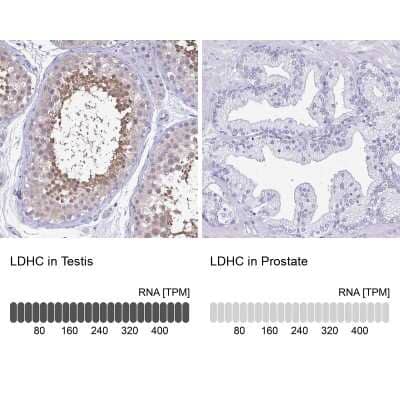 Immunohistochemistry-Paraffin Lactate Dehydrogenase C Antibody