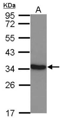 Western Blot Lactate Dehydrogenase C Antibody