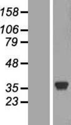 Western Blot: Lactate Dehydrogenase C Overexpression Lysate (Adult Normal) [NBL1-12473] Left-Empty vector transfected control cell lysate (HEK293 cell lysate); Right -Over-expression Lysate for Lactate Dehydrogenase C.