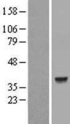 Western Blot: Lactate Dehydrogenase C Overexpression Lysate (Adult Normal) [NBL1-12474] Left-Empty vector transfected control cell lysate (HEK293 cell lysate); Right -Over-expression Lysate for Lactate Dehydrogenase C.