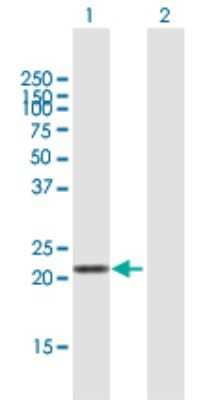 Western Blot: Laeverin Antibody [H00206338-B01P] - Analysis of LVRN expression in transfected 293T cell line by LVRN polyclonal antibody.  Lane 1: FLJ90650 transfected lysate(21.78 KDa). Lane 2: Non-transfected lysate.