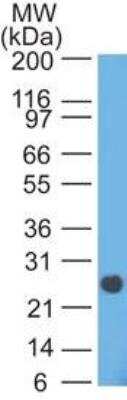 Western Blot: Lambda Light Chain Antibody (HP6054) [NBP2-22385] - Analysis of Lambda in human intestine using Lambda HP6054 antibody at 2 ug/ml, HRP secondary  and ECL substrate.