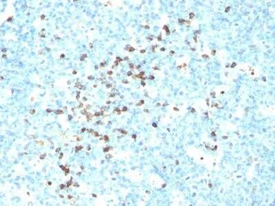 Immunohistochemistry-Paraffin: Lambda Light Chain Antibody (ICO-106) - Azide and BSA Free [NBP2-33311] - Formalin-paraffin human tonsil stained with Lambda Light Chain Ab (LcN-2). Note cell membrane & cytoplasmic staining.