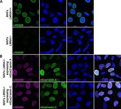 Immunocytochemistry/Immunofluorescence: Lamin A + C Antibody (LASS2D9) [NBP2-59937] - This antibody specifically detects lamin A and lamin C. (A) Wild-type mouse adult fibroblast (MAFs LMNA+/+) (upper panel) and LMNA-null MEFs (MAFs LMNA-/-) (lower panel) were methanol fixed and immunofluorescently stained with LASS2D9 mouse monoclonal antibody. (B) LMNA-null mouse adult fibroblast stably expressing mEos2-lamin A (upper panel) or mEos2-lamin C (lower panel) were fixed in cold methanol and stained with LASS2D9 antibody (magenta). Expression of the respective LMNA isoform is shown in green. The nuclei were counterstained with Hoechst. In LMNA-null MEFs there is a loss of LASS2D9 antibody staining signal. Rescue of LMNA-null cells with lamin A or lamin C expressing constructs restores the LASS2D9 antibody signal strongly suggesting that LASS2D9 specifically detects the products of LMNA gene.