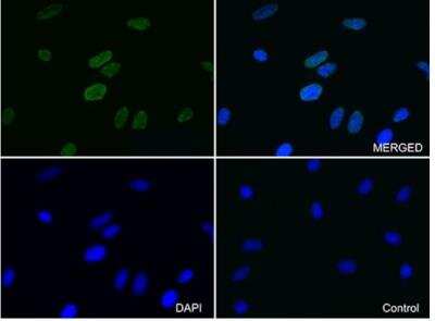 Immunocytochemistry/Immunofluorescence: Lamin A + C Antibody (OTI3F6) [NBP2-45654] - Staining of Hela cells using anti-LMNA mouse monoclonal antibody(green, upper left; merged, upper right) or Isotype control ( merged, lower right). Cell nuclei were stained with DAPI (blue, lower left) (1:100).