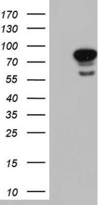 Western Blot: Lamin A + C Antibody (OTI3F6) [NBP2-45654] - Analysis of HEK293T cells were transfected with the pCMV6-ENTRY control (Left lane) or pCMV6-ENTRY Lamin A.