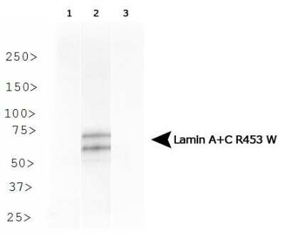 Western Blot: Lamin A + C R453W Antibody (12A-2F5) - Azide and BSA Free [NBP2-80823] - Analysis of Lamin A + C R453W in HeLa cells transfected with Flag-tagged Lamin A 1) wild type, 2) R453W and 3) R482W. Image from the standard format of this antibody.