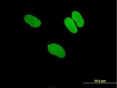 Immunocytochemistry/Immunofluorescence: Lamin A Antibody [H00004000-B01P] - Analysis of purified antibody to LMNA on HeLa cell. (antibody concentration 10 ug/ml)
