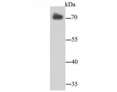 Western Blot: Lamin B2 Antibody (D5-C2) [NBP2-66924] - Staining LMNB2 in PC-3M cells (red). Cells were fixed in paraformaldehyde, permeabilised with 0.25% Triton X100/PBS.