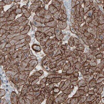 Immunohistochemistry-Paraffin: Laminin S/Laminin beta 2 Antibody (CL2976) [NBP2-42386] - Staining of human heart shows strong membranous immunoreactivity in cardiomyocytes.