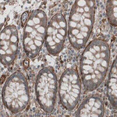 Immunohistochemistry-Paraffin: Laminin S/Laminin beta 2 Antibody (CL2976) [NBP2-42386] - Staining of human colon shows strong positivity in basement membrane of glandular epithelium.