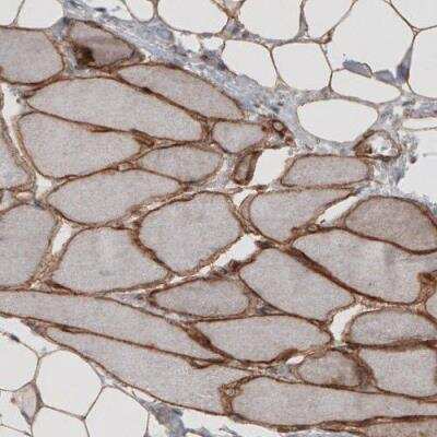 Immunohistochemistry-Paraffin: Laminin S/Laminin beta 2 Antibody (CL2976) [NBP2-42386] - Staining of human skeletal muscle shows strong membranous immunoreactivity in myocytes.