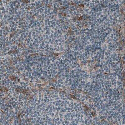 Immunohistochemistry-Paraffin: Laminin S/Laminin beta 2 Antibody (CL2976) [NBP2-42386] - Staining of human lymph node shows absence of immunoreactivity in lymphoid cells (negative control).