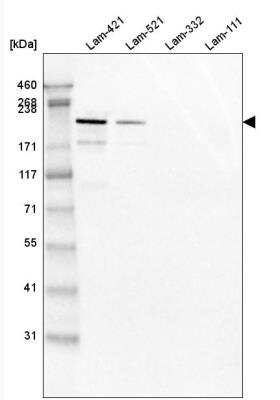 Western Blot: Laminin S/Laminin beta 2 Antibody (CL2976) [NBP2-42386] - Analysis of purified human recombinant Laminin-421, Laminin-521, Laminin-332 and Laminin-111.