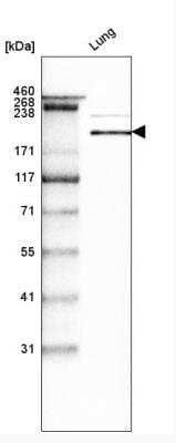 Western Blot: Laminin S/Laminin beta 2 Antibody (CL2976) [NBP2-42386] - Analysis in human lung tissue.