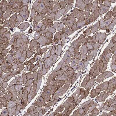 Immunohistochemistry-Paraffin: Laminin S/Laminin beta 2 Antibody (CL2979) [NBP2-42387] - Staining of human heart muscle shows moderate membranous positivity in cardiomyocytes.