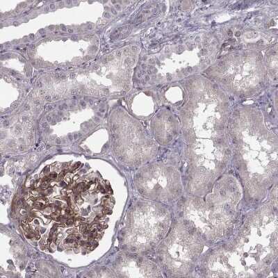 Immunohistochemistry-Paraffin: Laminin S/Laminin beta 2 Antibody (CL2979) [NBP2-42387] - Staining of human kidney shows moderate membranous positivity in basement membrane of cells in glomeruli.