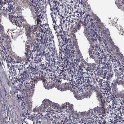 Immunohistochemistry-Paraffin: Laminin S/Laminin beta 2 Antibody (CL2979) [NBP2-42387] - Staining of human endometrium shows moderate positivity in basement membrane of glandular cells.