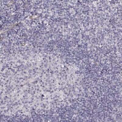 Immunohistochemistry-Paraffin: Laminin S/Laminin beta 2 Antibody (CL2979) [NBP2-42387] - Staining of human tonsil shows no positivity in lymphoid cells as expected.