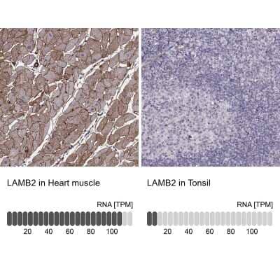 Immunohistochemistry-Paraffin: Laminin S/Laminin beta 2 Antibody (CL2979) [NBP2-42387] - Staining in human heart muscle and tonsil tissues. Corresponding LAMB2 RNA-seq data are presented for the same tissues.