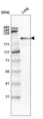 Western Blot: Laminin S/Laminin beta 2 Antibody (CL2979) [NBP2-42387] - Analysis in human lung tissue.