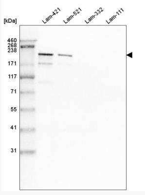 <b>Orthogonal Strategies Validation. </b>Western Blot: Laminin S/Laminin beta 2 Antibody (CL2979) [NBP2-42387] - Analysis of purified human recombinant Laminin-421, Laminin-521, Laminin-332 and Laminin-111.