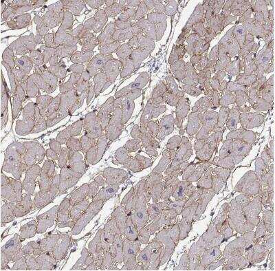 Immunohistochemistry-Paraffin: Laminin S/Laminin beta 2 Antibody [NBP1-87717] - Staining of human heart muscle shows weak to moderate membranous positivity in cardiomyocytes.