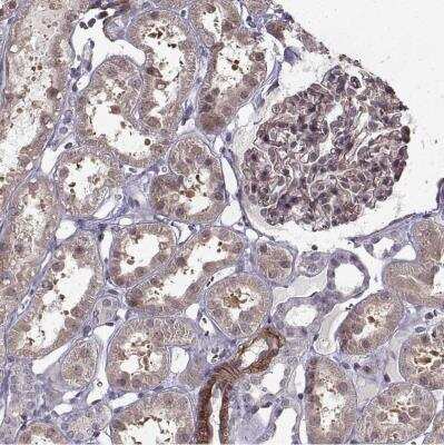 Immunohistochemistry-Paraffin: Laminin S/Laminin beta 2 Antibody [NBP1-87717] -  Staining of human kidney shows weak to moderate membranous positivity in cells in glomeruli.