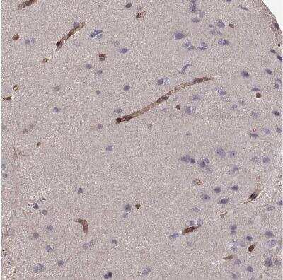 Immunohistochemistry-Paraffin: Laminin S/Laminin beta 2 Antibody [NBP1-87717] -  Staining of human cerebral cortex shows moderate membranous positivity in endothelial cells.