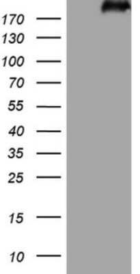 Western Blot: Laminin S/Laminin beta 2 Antibody (OTI3B4) - Azide and BSA Free [NBP2-71114] - Analysis of HEK293T cells were transfected with the pCMV6-ENTRY control (Left lane) or pCMV6-ENTRY Laminin S.